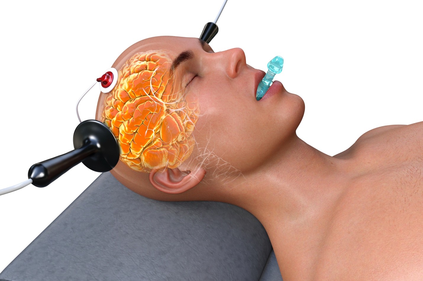 Electroconvulsive Therapy Services in Hyderabad